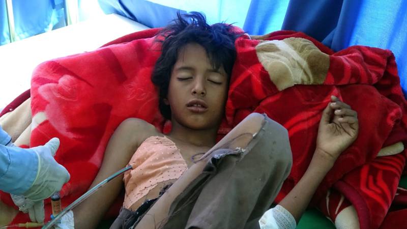 Yemeni boy victim of Saudi airstrike in hospital, AFP photo