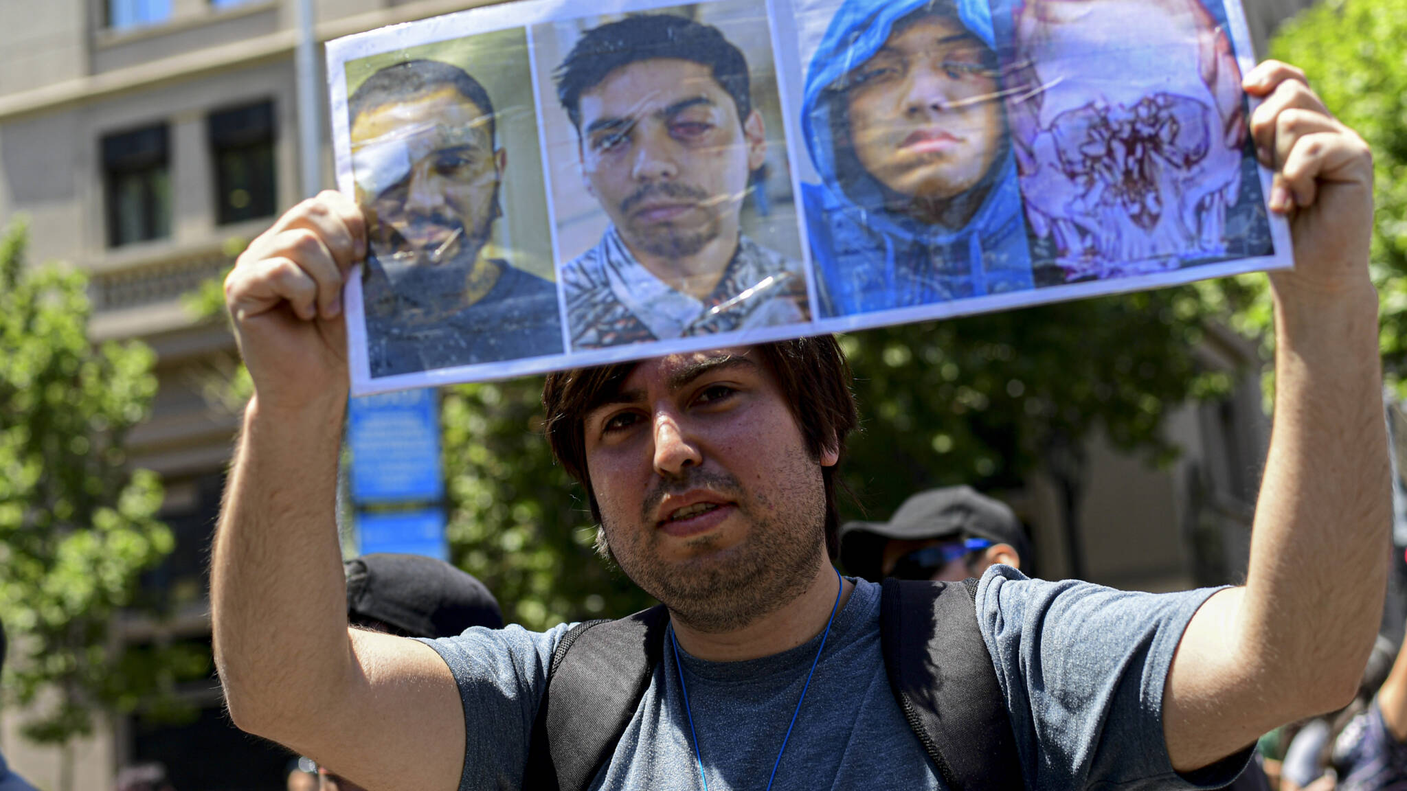 Chilean demonstrator with photos of blinded people, AFP photo